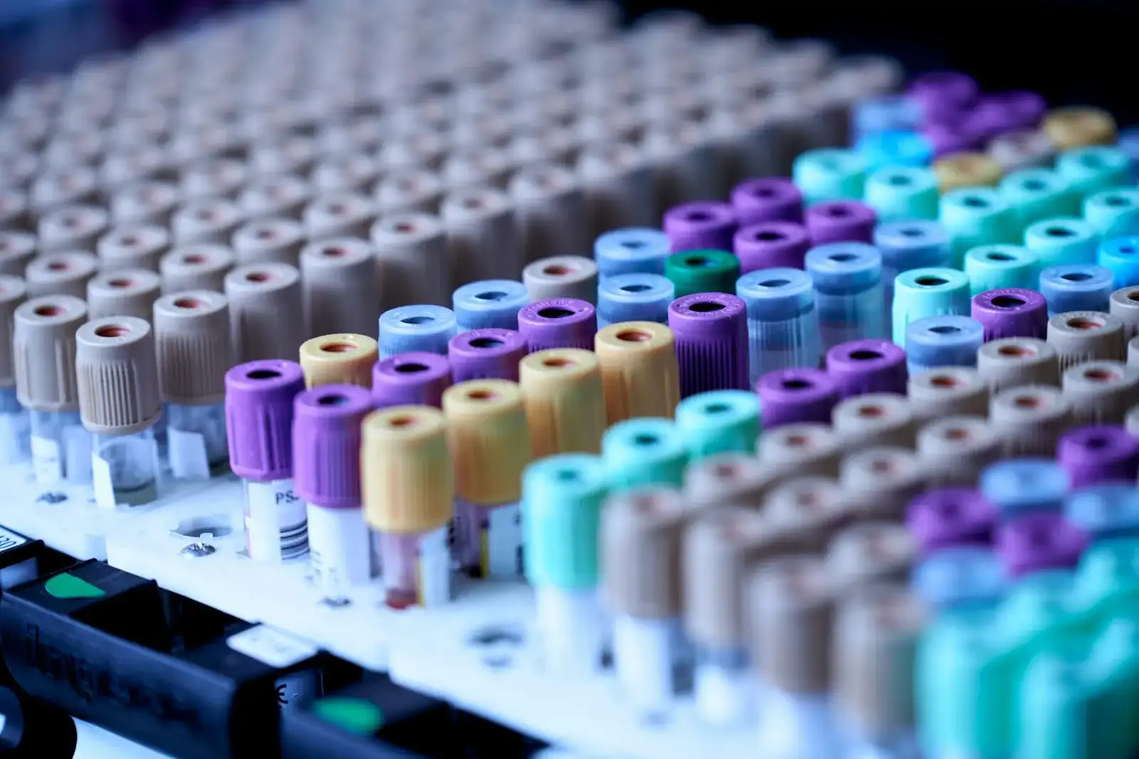 Rows of medical blood collection tubes with color-coded stopper caps organized in a laboratory rack
